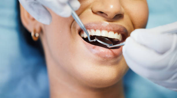 Best Lost Filling or Crown Replacement in Salton City, CA
