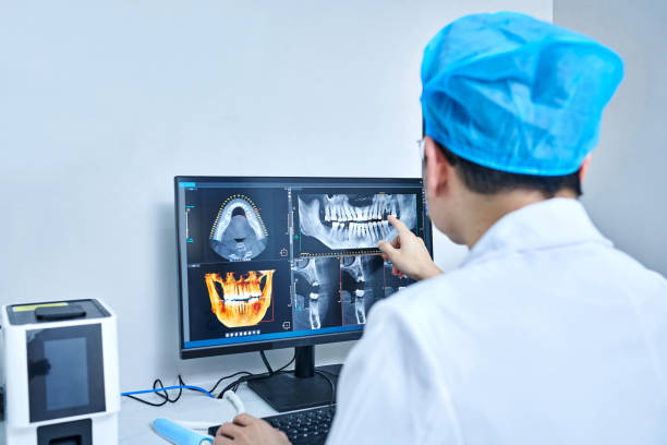 Best Emergency Wisdom Tooth Extraction in Salton City, CA